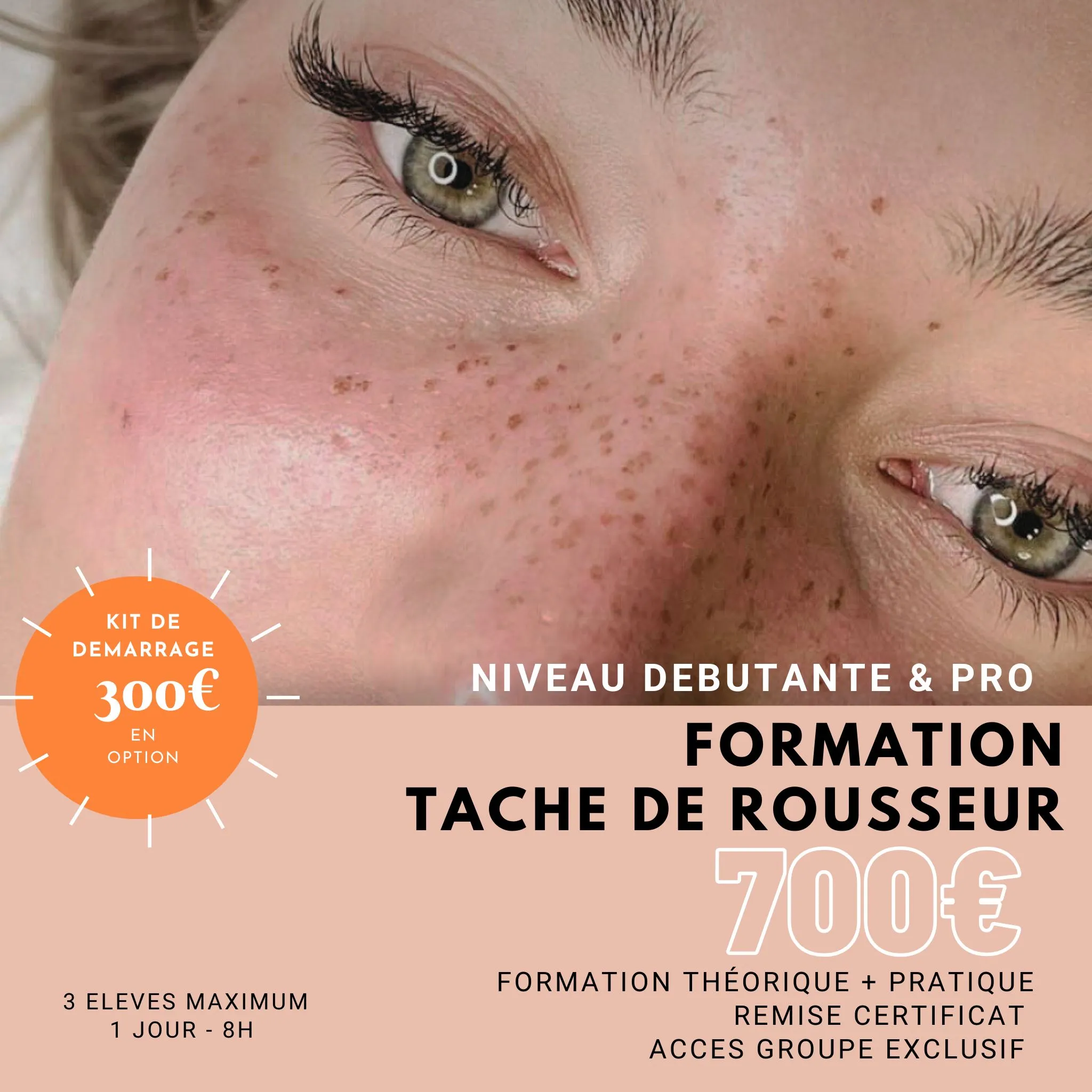 Informations de Formation Tâche de Rousseur à Dijon