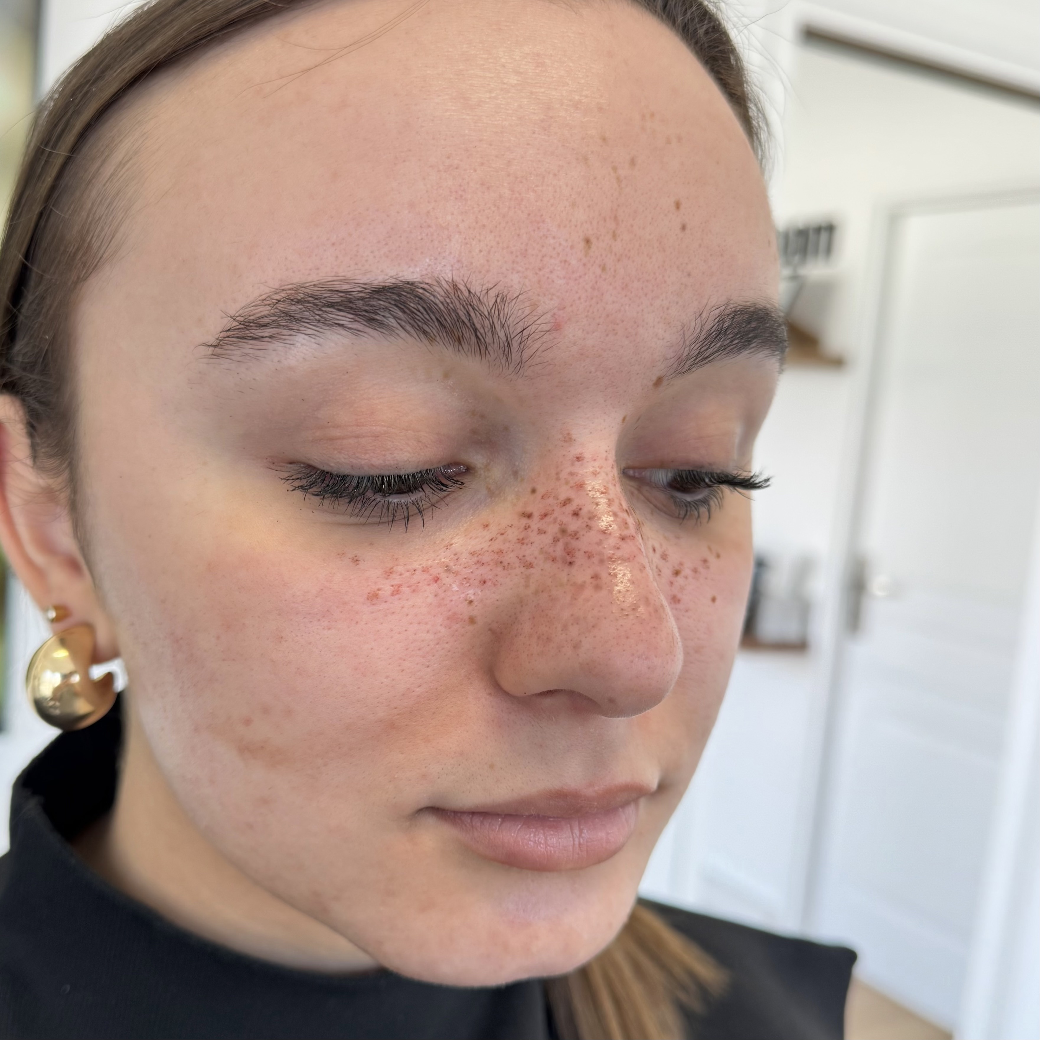 Tatouage cosmétique de fausses taches de rousseur réalisé à Dijon par Habiba Med, maquillage semi-permanent naturel.